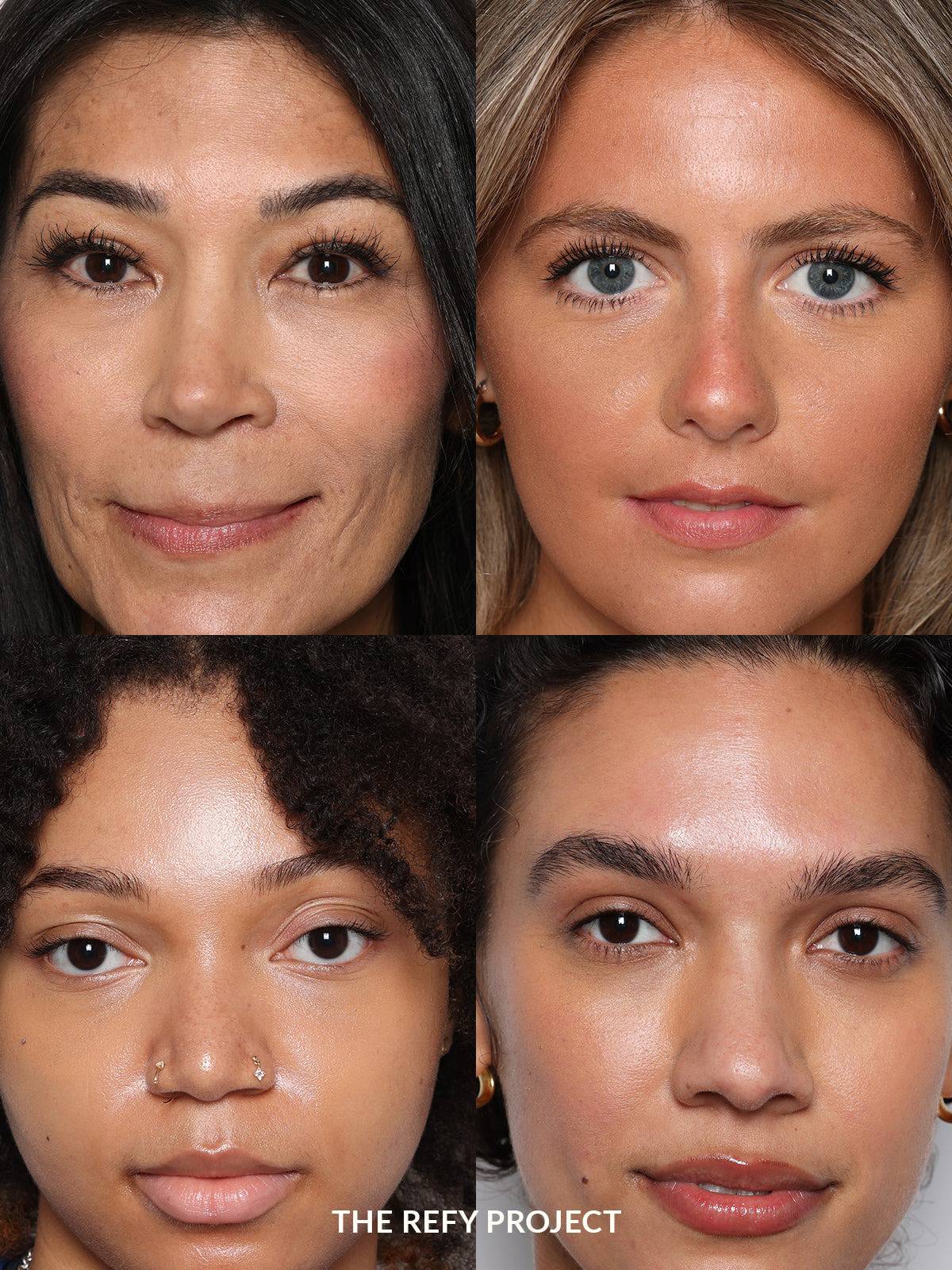 Refy Concealer - Concealer