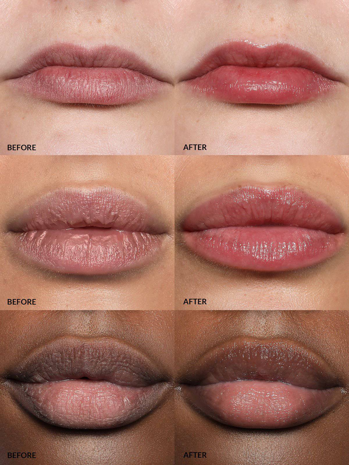 Refy Lip Buff - Lip Plumper