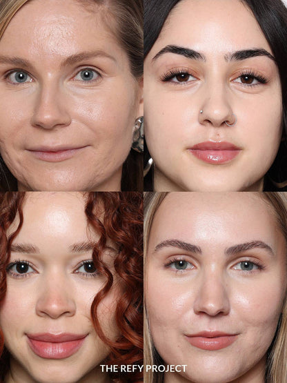 Refy Concealer - Concealer