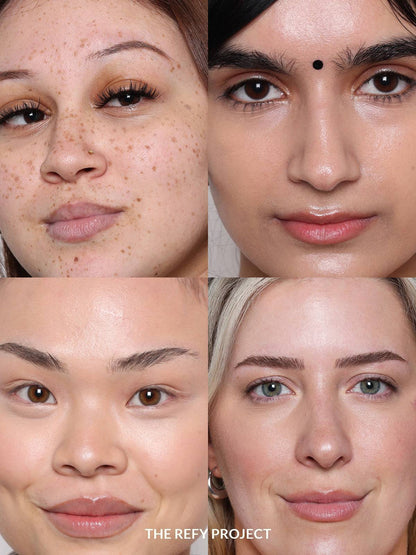 Refy Concealer - Concealer